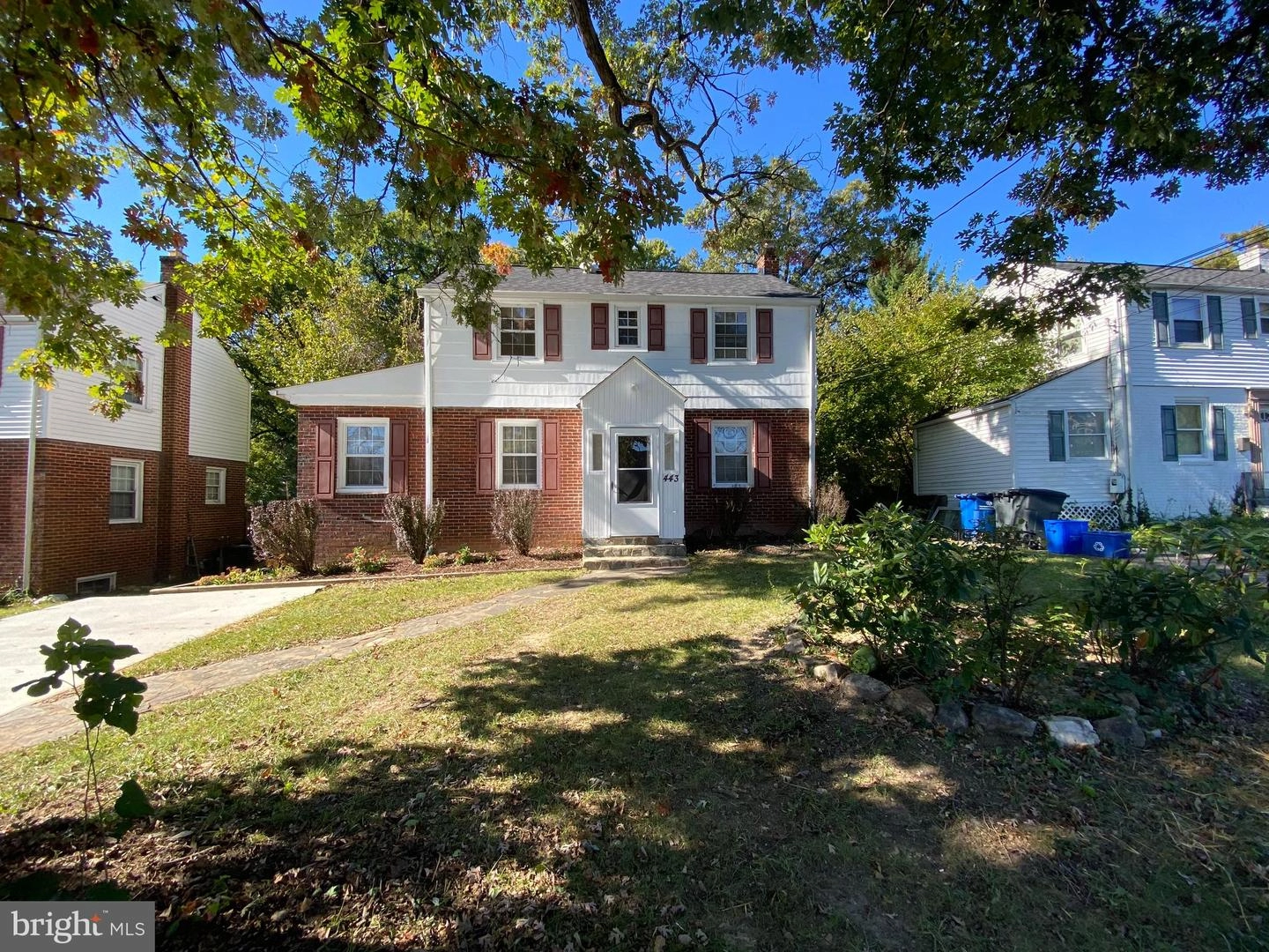 443 University Blvd E, Silver Spring, MD 20901 photo 20
