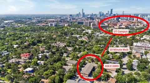 View/Area - 304 E 33rd St #4, Austin, TX 78705 photo 4 of 4