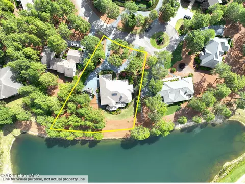View/Area - 4 Interlachon Ln, Pinehurst, NC 28374 photo 7 of 7