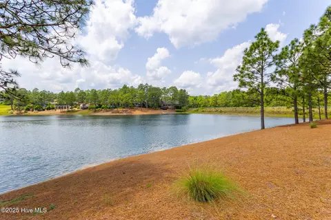 View/Area - 4 Interlachon Ln, Pinehurst, NC 28374 photo 1 of 7
