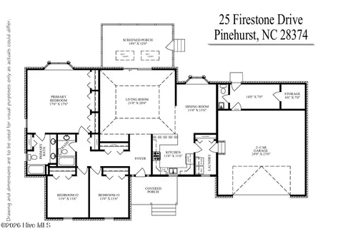 25 Firestone Ln, Pinehurst, NC 28374
