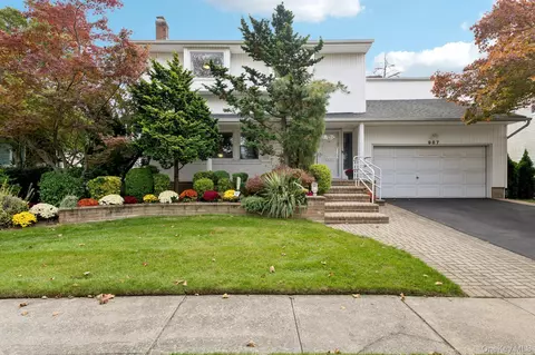 987 S End, Woodmere, NY 11598