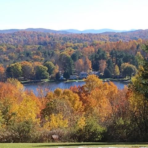 123 Summit Lake Rd, Argyle, NY 12809 photo 67