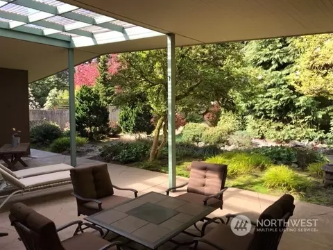 Exterior - 18819 92nd Ave NE, Bothell, WA 98011 photo 6 of 10