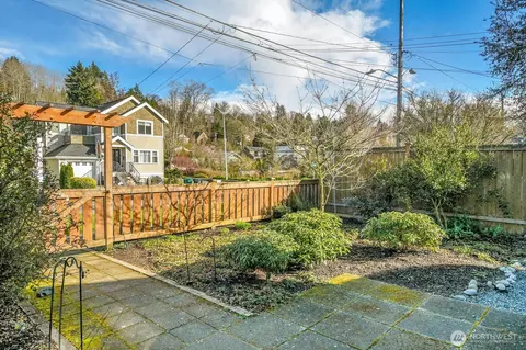 Exterior - 205 30th Ave E, Seattle, WA 98112 photo 3 of 6