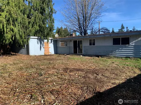 Exterior - 19424 Winesap Rd, Bothell, WA 98012 photo 7 of 8
