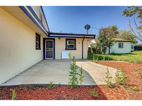 5535 Tejon St, Denver, CO 80221 photo 19