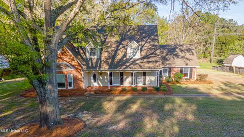 9 Deerfield Dr, Madison, MS 39110 photo 61