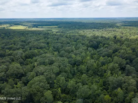 0 Star Road Rd, Brandon, MS 39042 photo 43