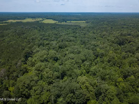 0 Star Road Rd, Brandon, MS 39042 photo 28