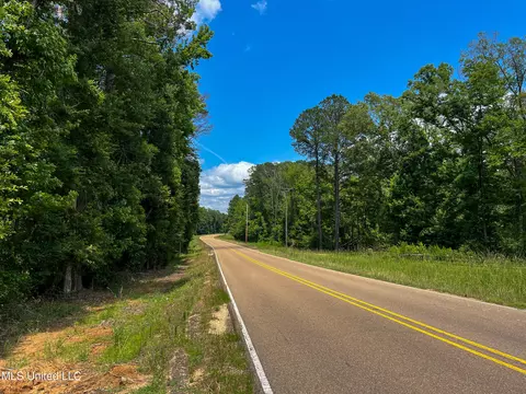 0 Star Road Rd, Brandon, MS 39042 photo 64