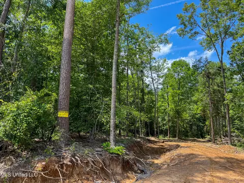 0 Star Road Rd, Brandon, MS 39042 photo 62