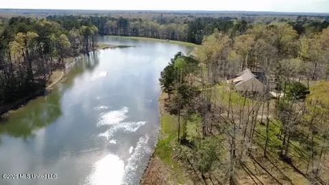 0 Star Rd, Brandon, MS 39042 photo 4